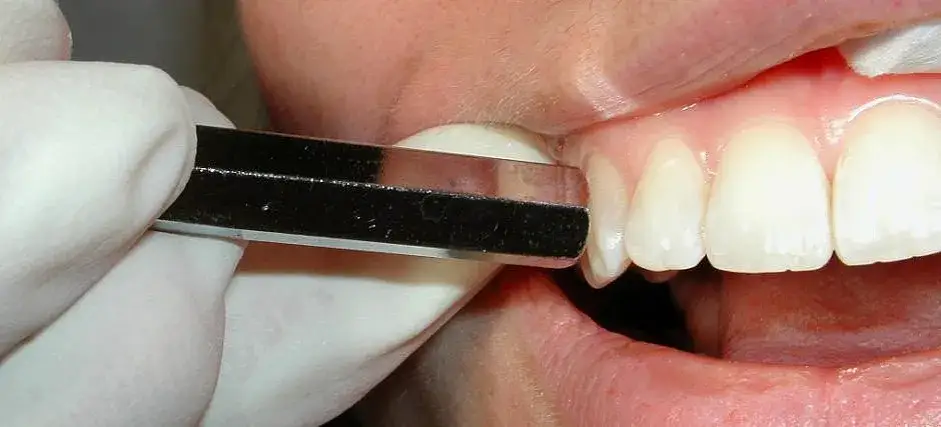 dentysta test opukiwania zęba