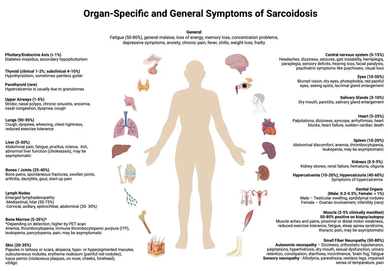 Sarkoidose-Symptome: M&uuml;digkeit, Gelenkschmerzen, Hautver&auml;nderungen, Husten, Augenprobleme, neurologische St&ouml;rungen und mehr.