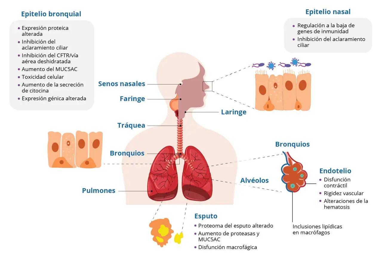 Ilustración de los efectos del vapeo en los pulmones, mostrando alteraciones en el epitelio bronquial y nasal, y en los alvéolos.