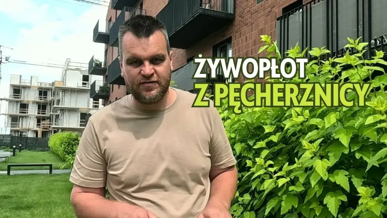 Zdjęcie Jak sadzić pęcherznicę w żywopłocie, aby uniknąć błędów w odległości?