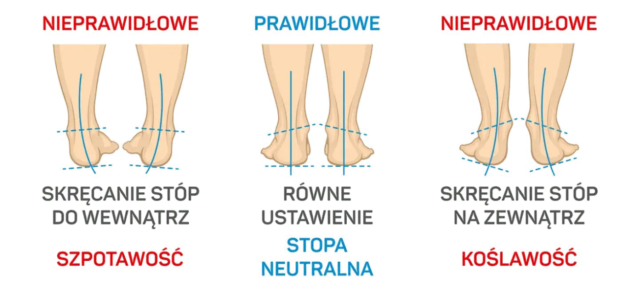 Zdjęcie Wiotkość stawów do jakiego lekarza? Sprawdź, co musisz wiedzieć