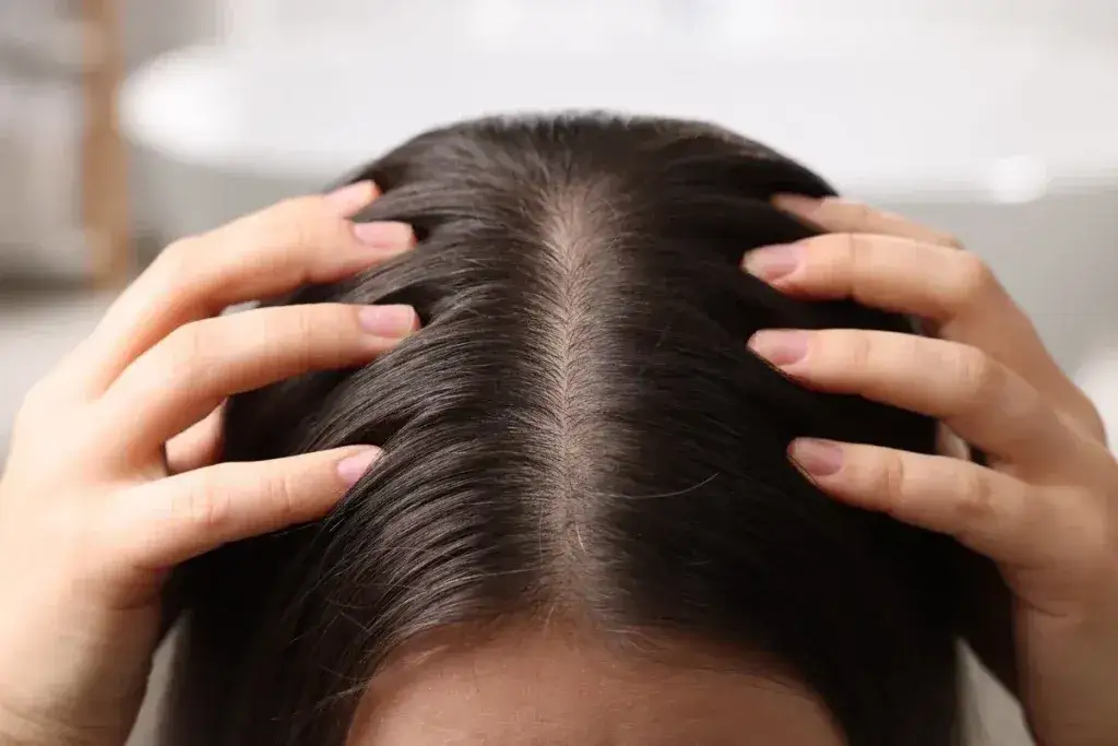 Zdjęcie Ile trzymać peeling na głowie, aby uniknąć podrażnień skóry?