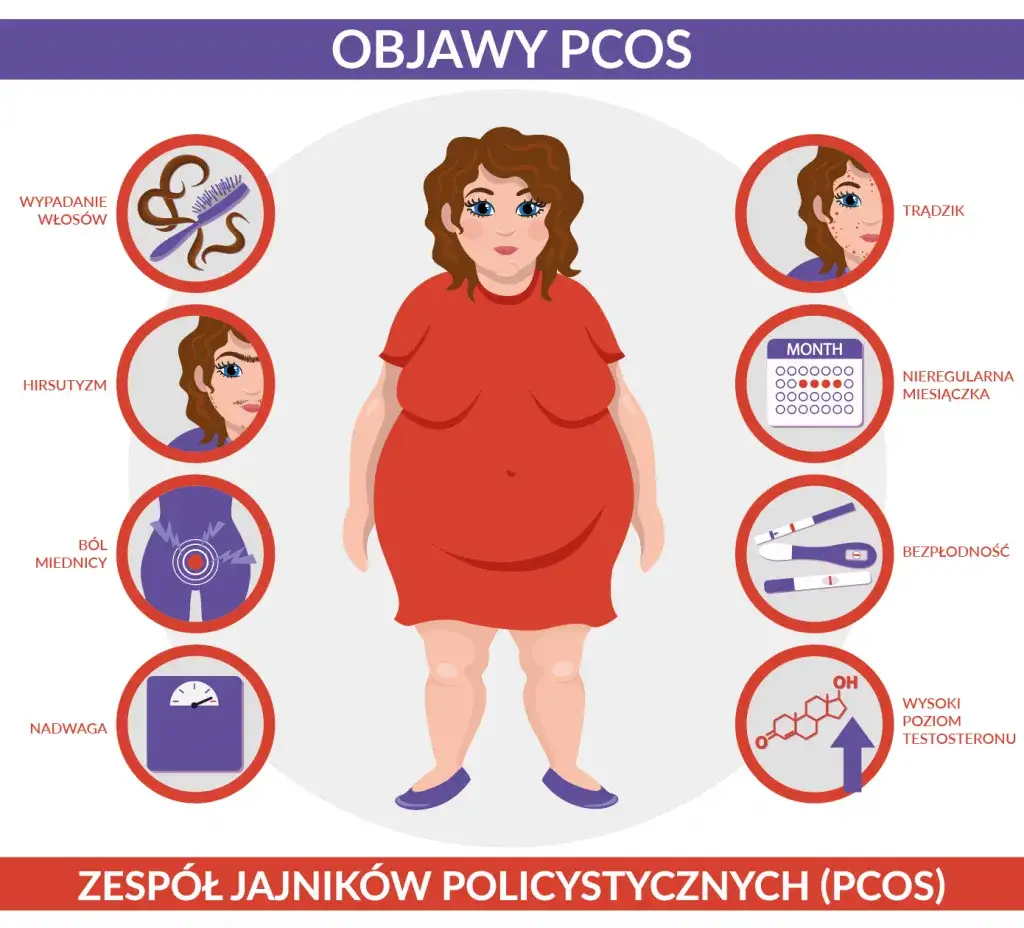 Zdjęcie Zesp&oacute;ł policystycznych jajnik&oacute;w: Objawy, diagnoza i jak sobie z nim radzić