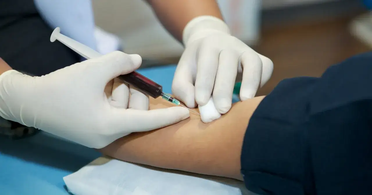 Zdjęcie Cholesterol czy na czczo? Sprawdź, co mówią nowe wytyczne