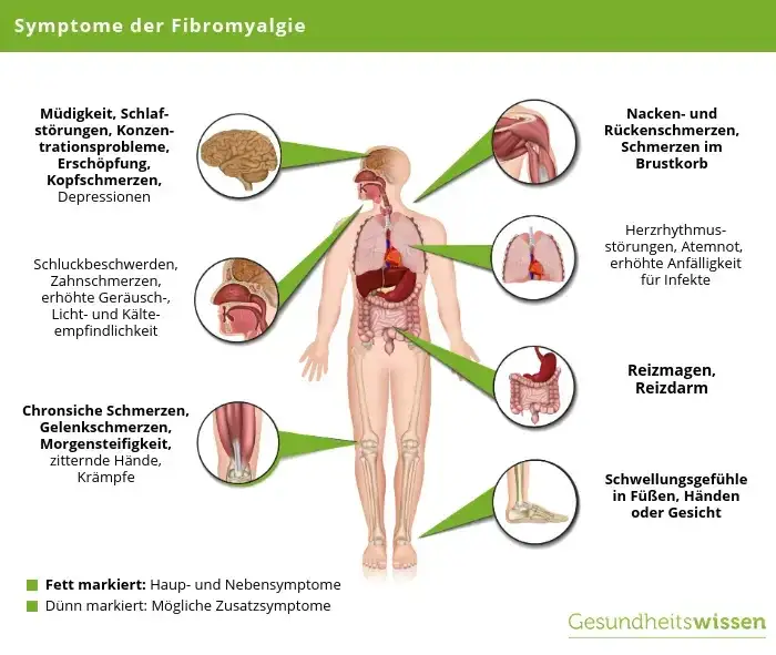 Zdjęcie Fibromyalgie neurologische Symptome: Verborgene Anzeichen erkennen und bew&auml;ltigen