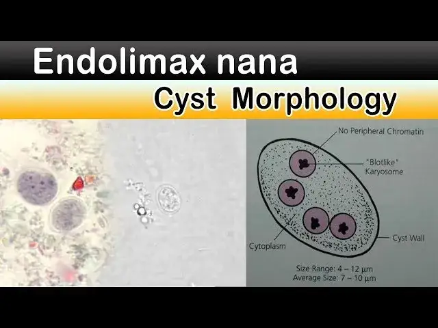 Zdjęcie Endolimax nana: 5 objawów infekcji i metody skutecznego leczenia