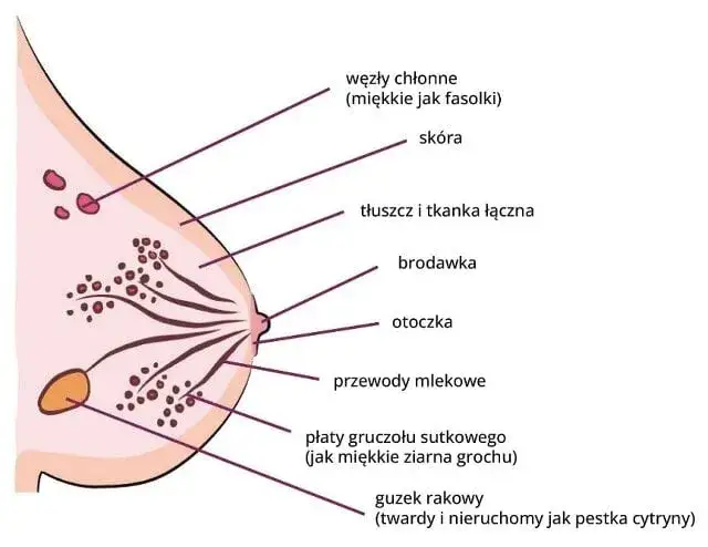 Zdjęcie Co oznacza symbol choroby N63: nieokreślony guzek w piersi - diagnoza