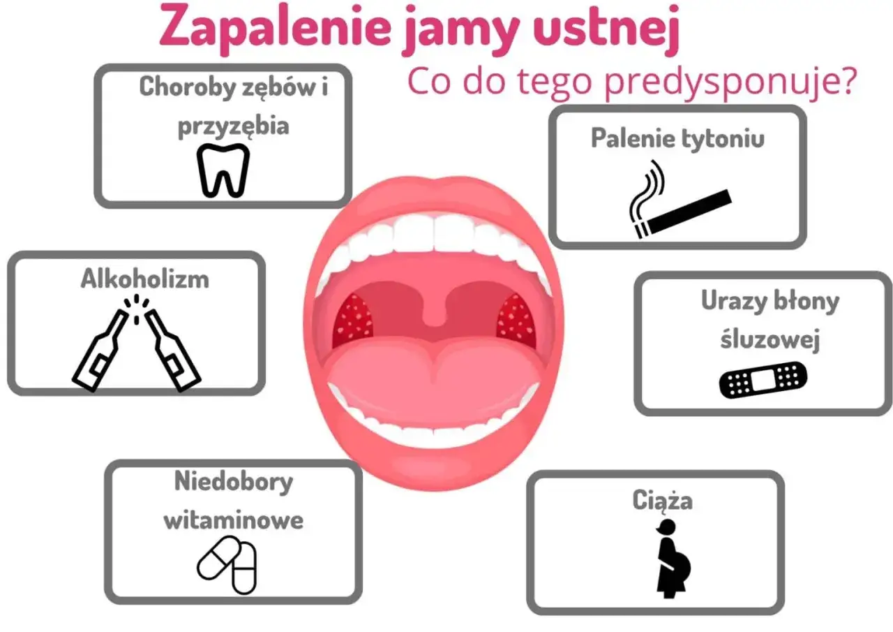 Zdjęcie Choroby jamy ustnej: do jakiego lekarza się udać i jak uniknąć powikłań