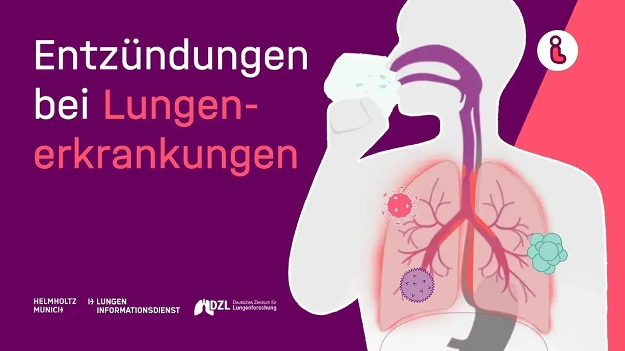 Zdjęcie Symptome bei einer Lungenentz&uuml;ndung: So erkennen Sie die Anzeichen