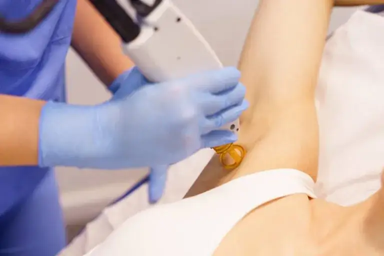 Depilacja laserowa: czy boli? Poznaj prawdę i metody łagodzenia bólu