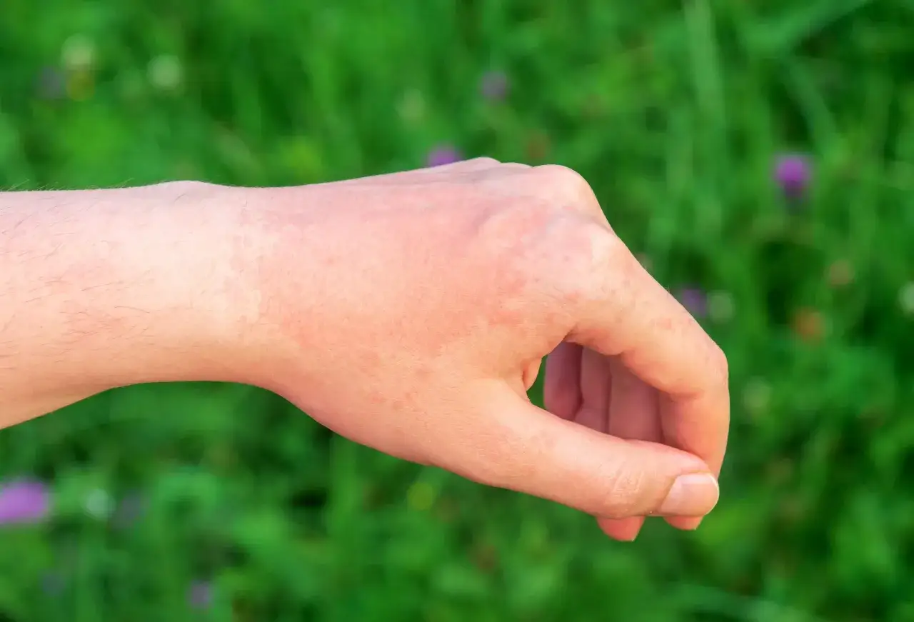 Alergia: Kiedy leki zaczynają działać? Szybka ulga i mity
