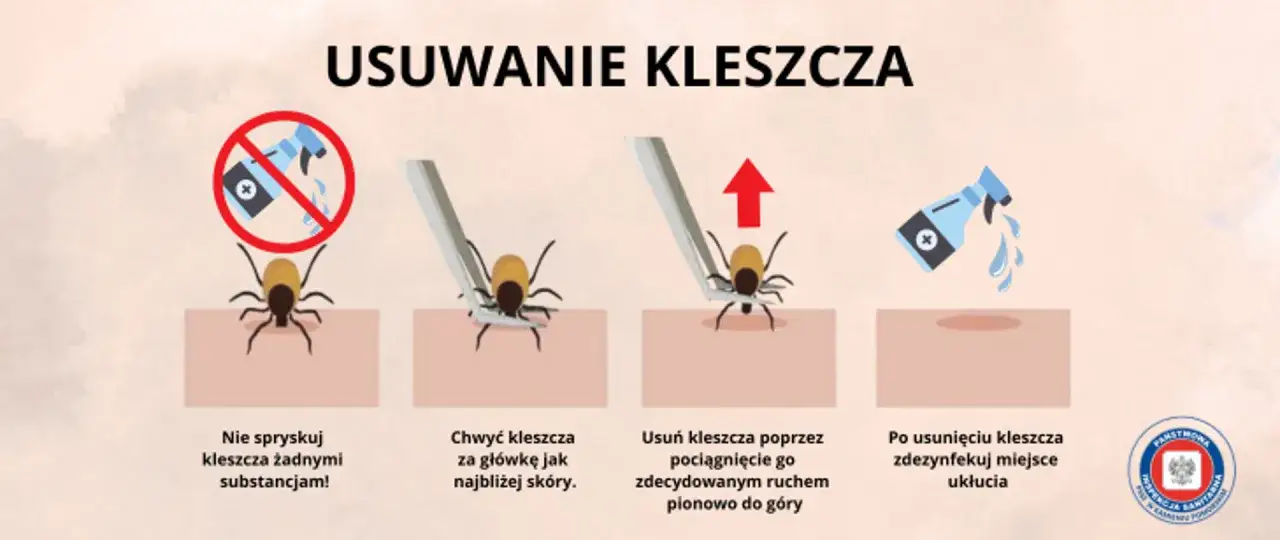 Kleszcz: Wyciągnij, nie wykręcaj! Prawidłowa instrukcja krok po kroku