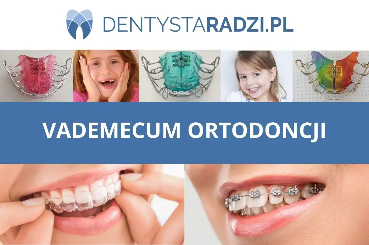 Kto zakłada aparat na zęby? Poznaj rolę ortodonty i proces leczenia