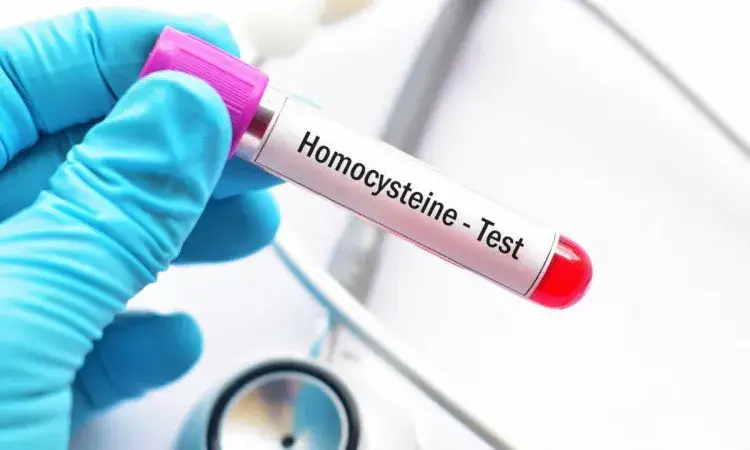 Badanie homocysteiny: Co to jest, normy i kiedy je wykonać?