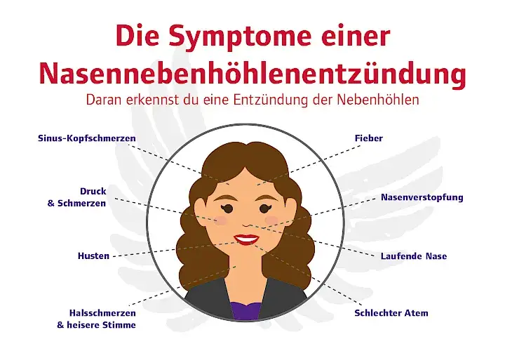 Nebenhöhlenentzündung Symptome: Erkennen Sie die Warnzeichen rechtzeitig