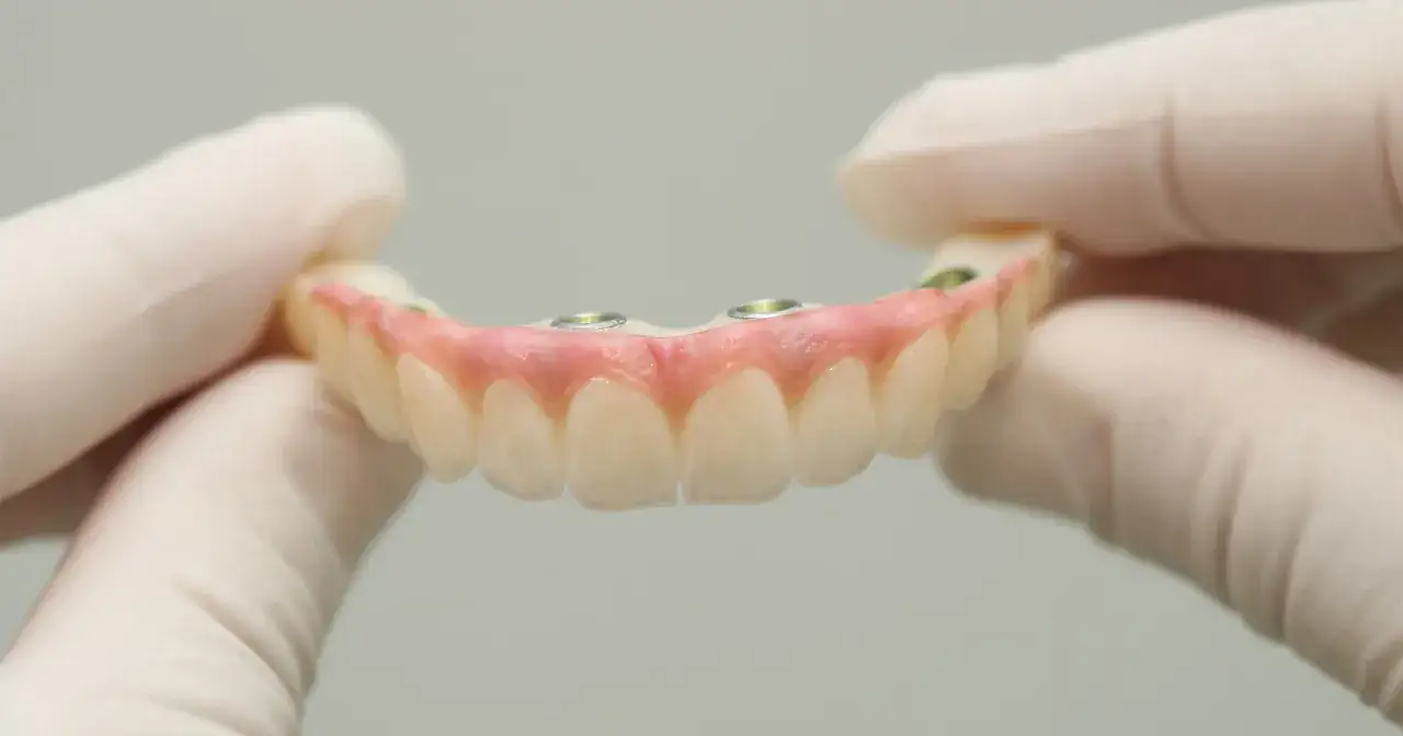 Dłonie w rękawiczkach trzymają protezę zębową na implantach. Dofinansowanie do protezy zębowej może pomóc w odzyskaniu pięknego uśmiechu.