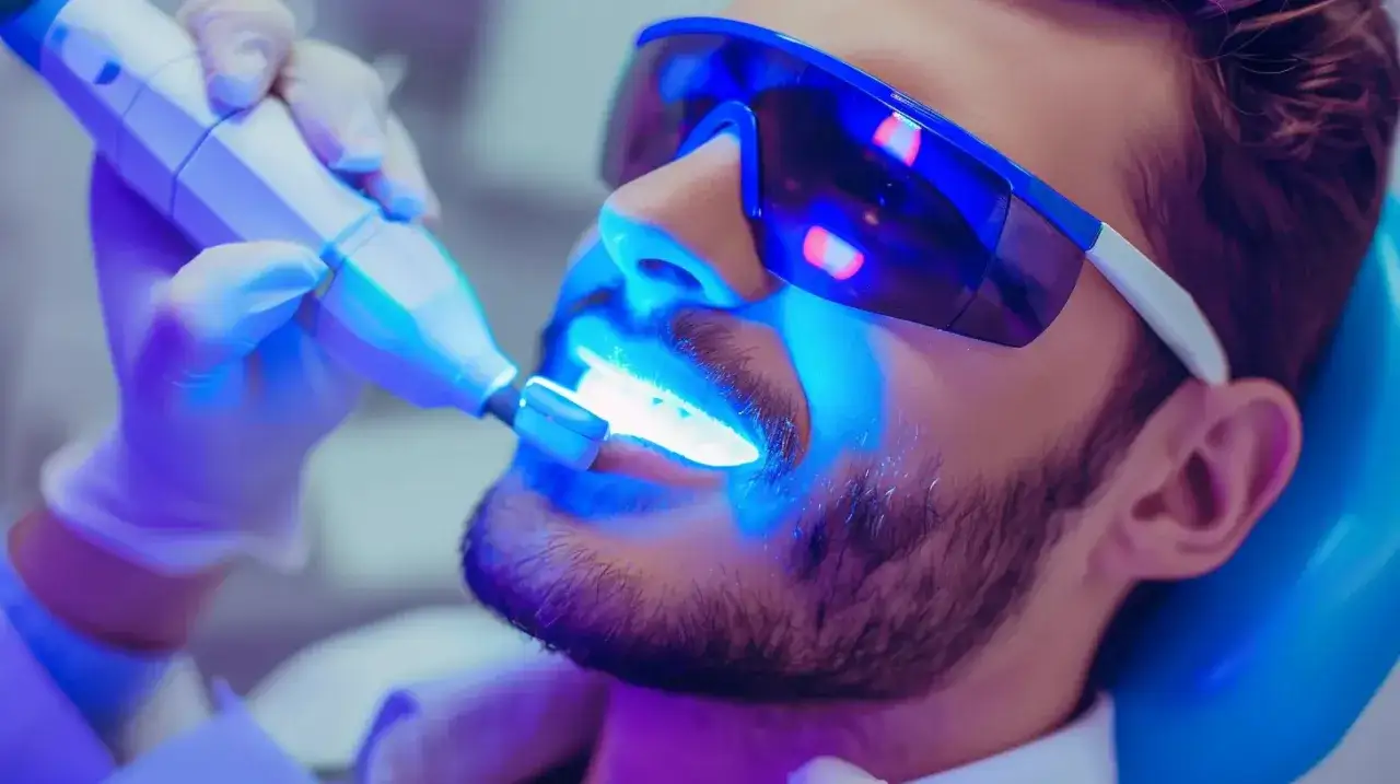 Wybielanie zębów u dentysty: czy warto? Analiza kosztów i efektów