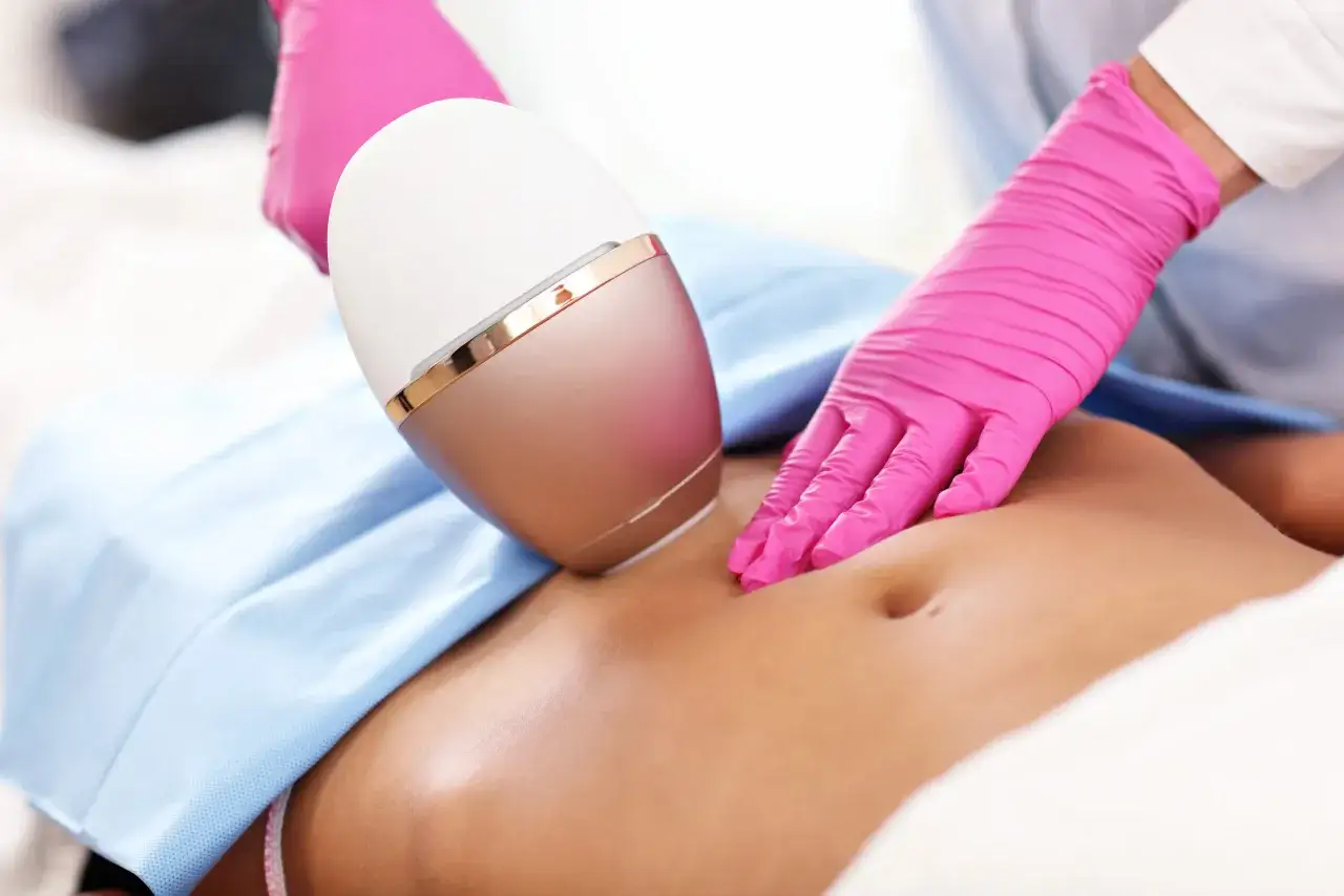 Zabieg depilacji bikini płytkiej z użyciem nowoczesnego urządzenia. Dłonie w różowych rękawiczkach trzymają głowicę lasera.