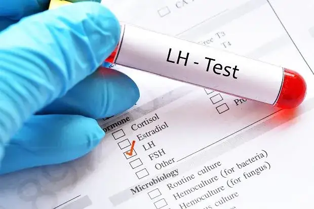 LH badanie u mężczyzn: wszystko co musisz wiedzieć o diagnostyce hormonu