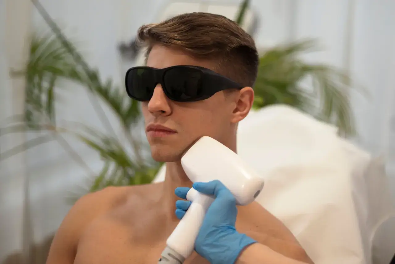 Mężczyzna w okularach ochronnych przechodzi zabieg depilacji laserowej brody.
