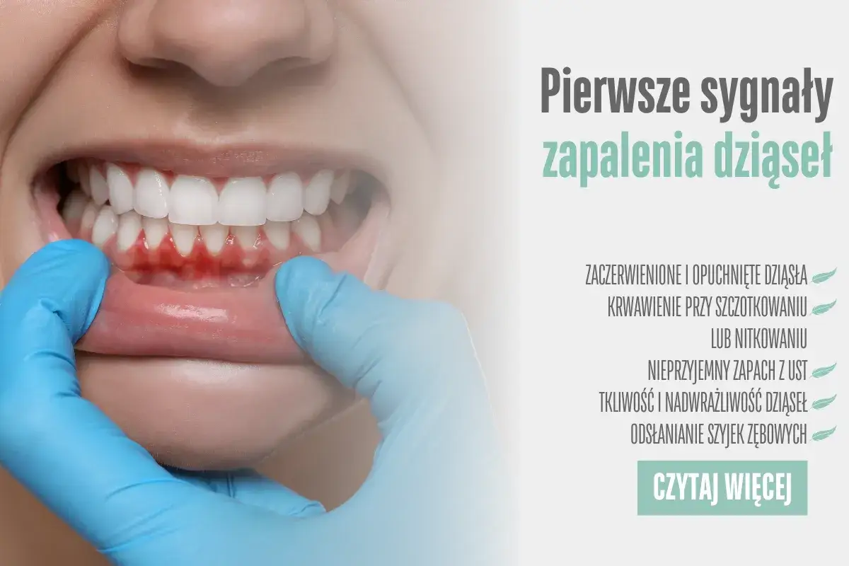 Zapalenie dziąseł: 7 objawów, których nie wolno ignorować!