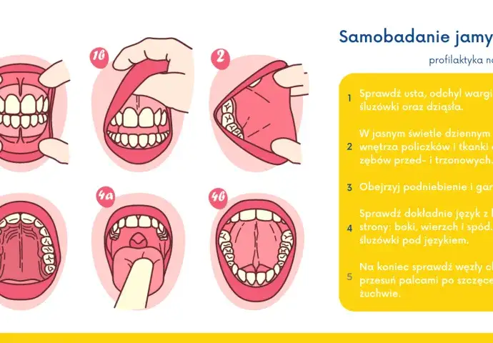 lokalizacje raka jamy ustnej mapa