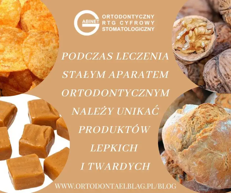 produkty zakazane z aparatem ortodontycznym