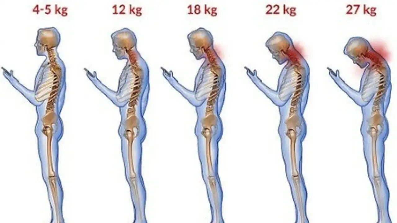 stopnie skręcenia kręgosłupa szyjnego infografika