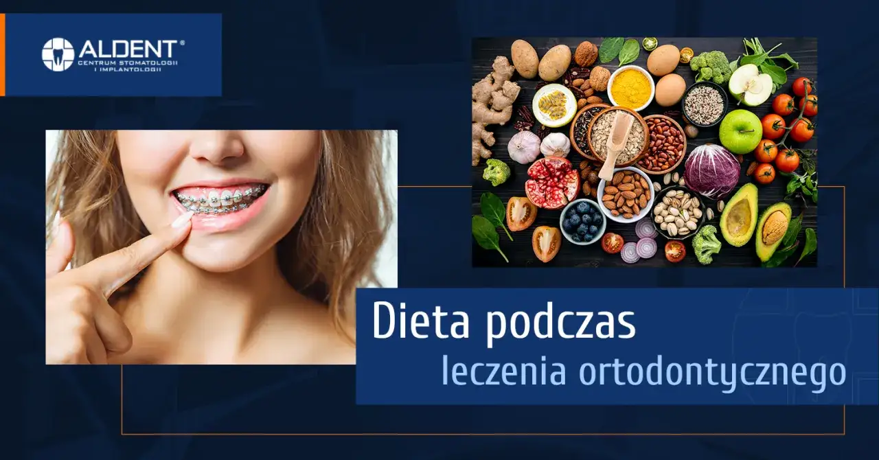 znaczenie diety w leczeniu ortodontycznym, aparat ortodontyczny wpływ jedzenia