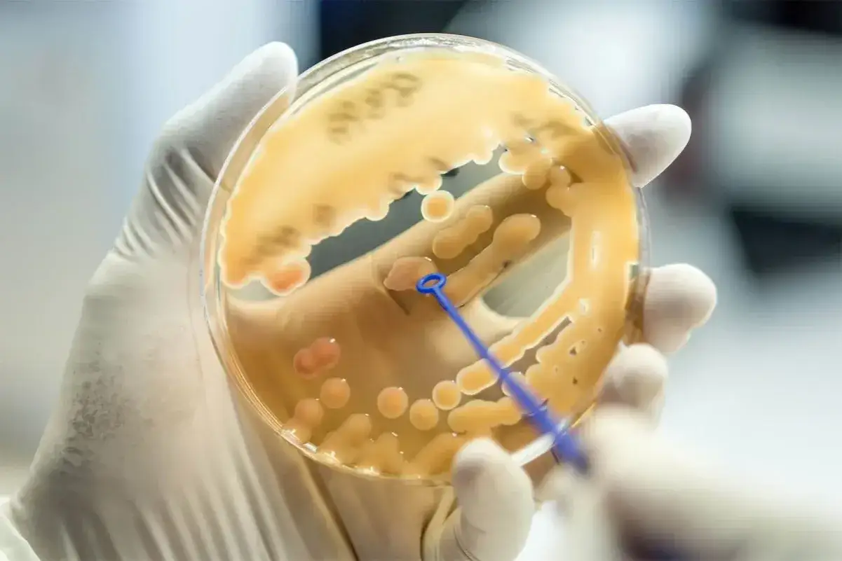 Laboratorium mikrobiologiczne bada mikroorganizmy. Na szalce Petriego rosną kolonie bakterii, kt&oacute;re są badane przez naukowca w rękawiczce.