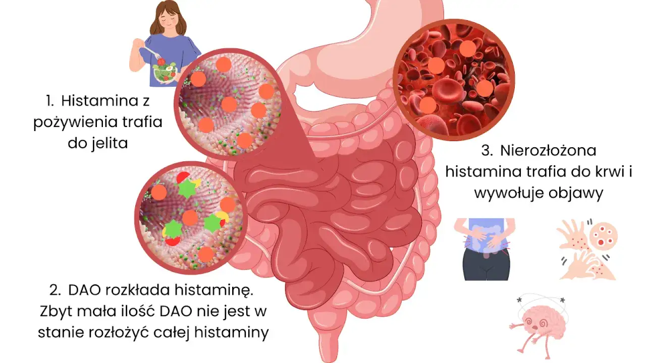 Histamina z pożywienia trafia do jelita, gdzie DAO pr&oacute;buje ją rozłożyć. Nierozłożona histamina trafia do krwi, wywołując objawy.