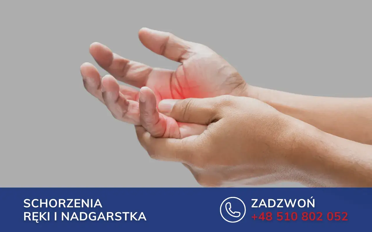 Dłoń z zaczerwienionym obszarem na wewnętrznej stronie, wskazującym na twardy guzek.