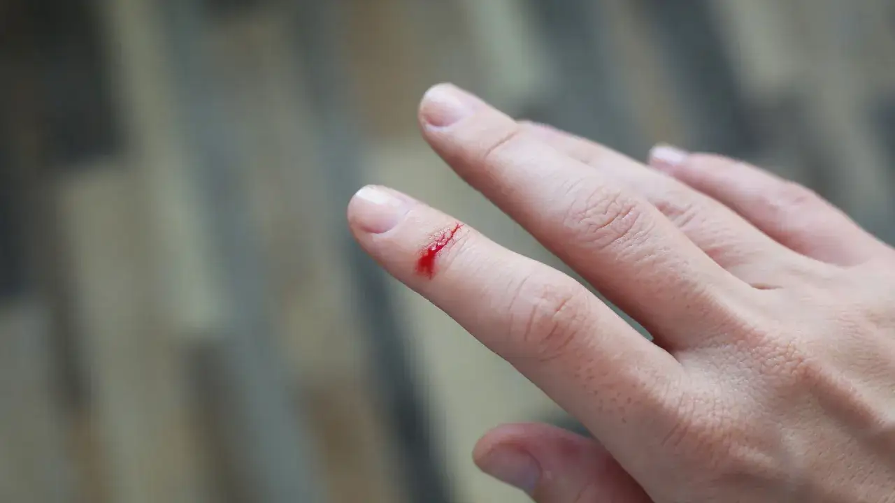 Zdjęcie Gumki na palce - jak chronić palce i skaleczenia przed infekcją?