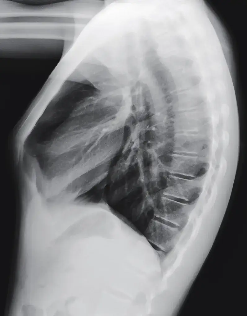 Zdjęcie Pectus co znaczy po polsku? Łacińskie słowo w anatomii