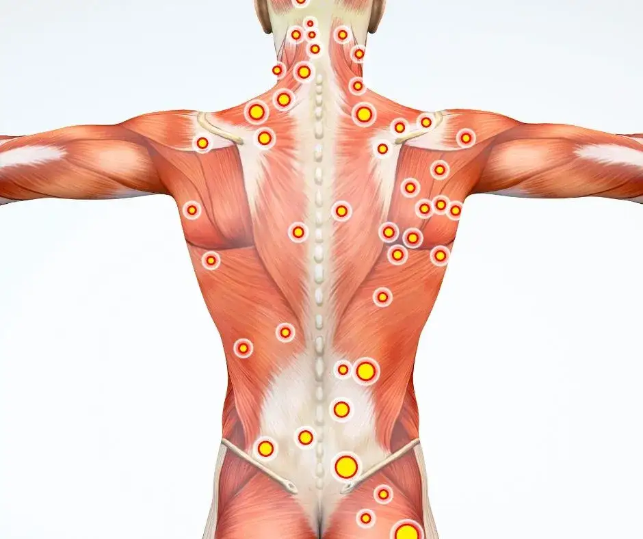 Mapa mięśni plec&oacute;w do masażu