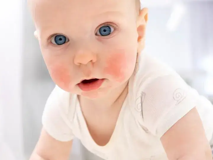 dziecko z alergią pokarmową wiek objawy