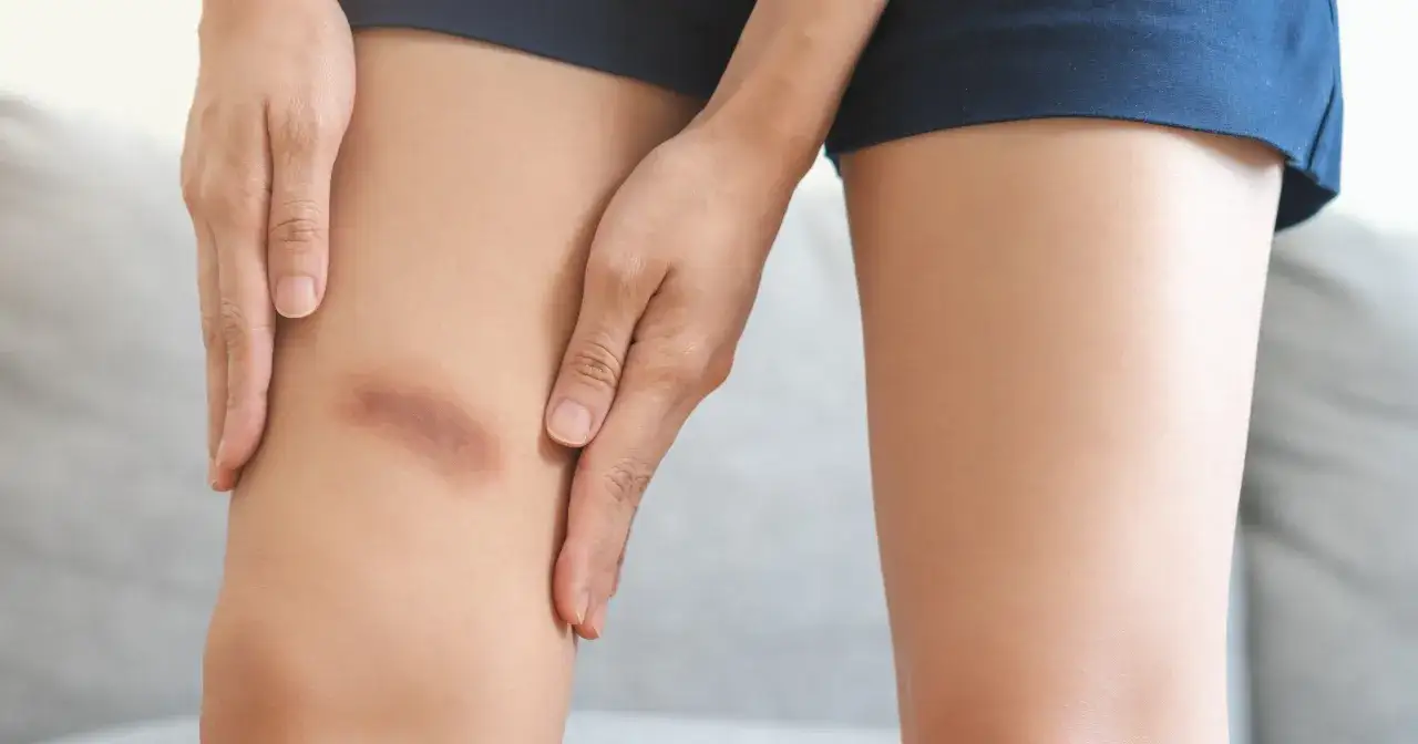 siniaki na nogach różne rodzaje