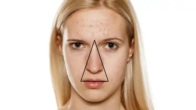 trójkąt śmierci twarz anatomia