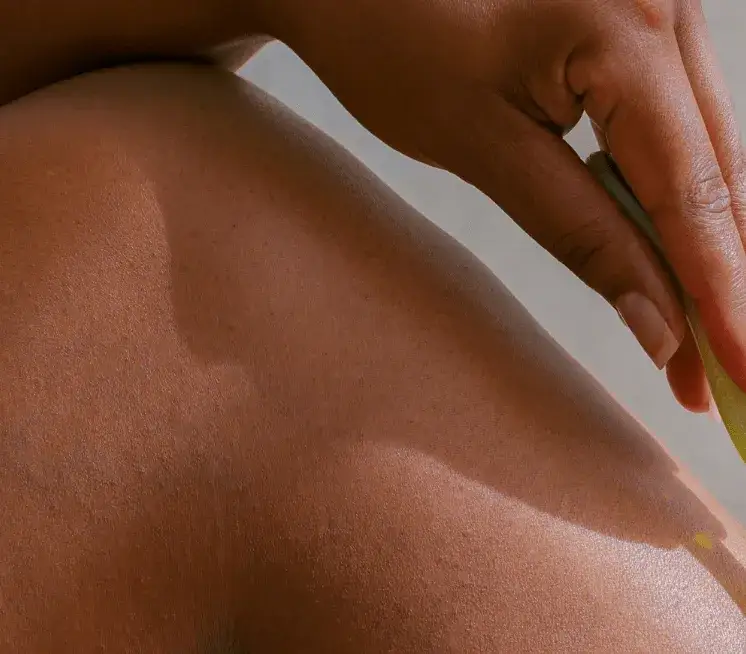 Zdjęcie Jak pozbyć się krost po goleniu bikini - skuteczne metody i porady