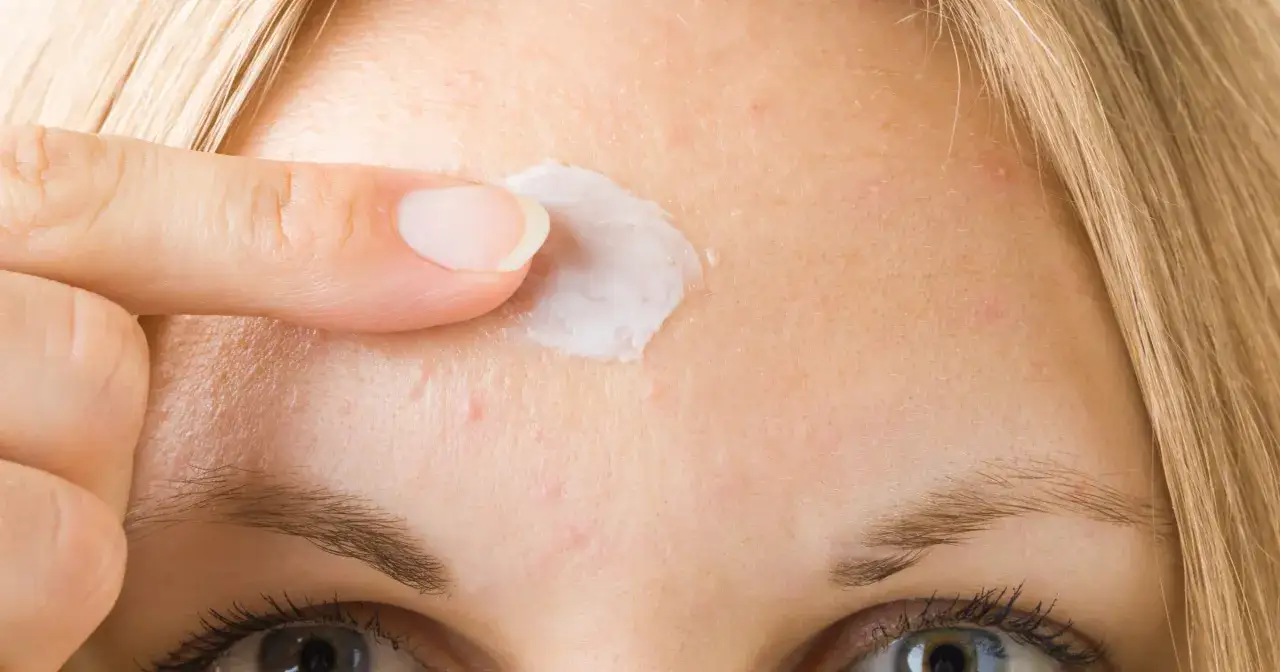 Palec nakłada krem na czoło. To jak złoto z Madagaskaru, maść w aptece, która pomaga na niedoskonałości skóry.