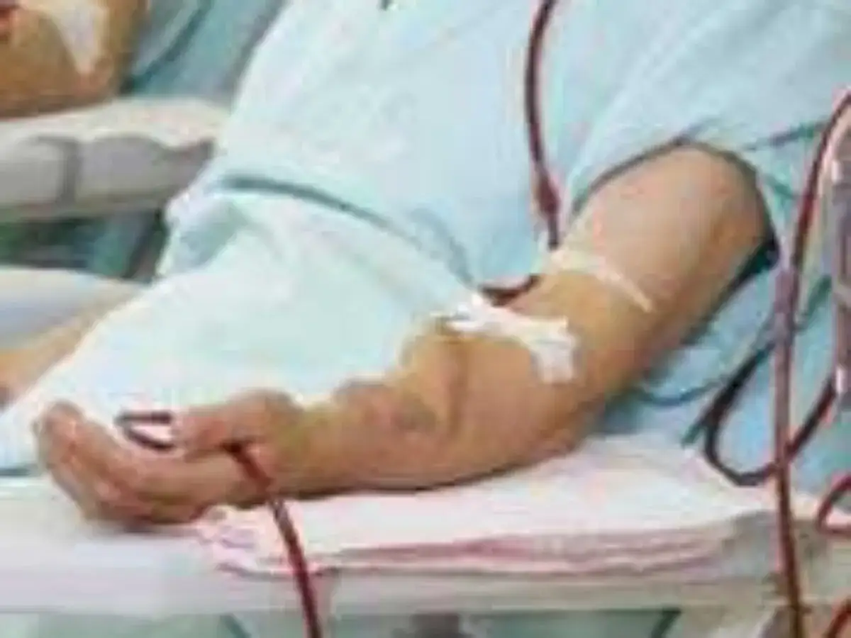 Ramię pacjenta podłączone do aparatury do leczenia nerkozastępczego. Czerwone przewody biegną od ręki do maszyny.