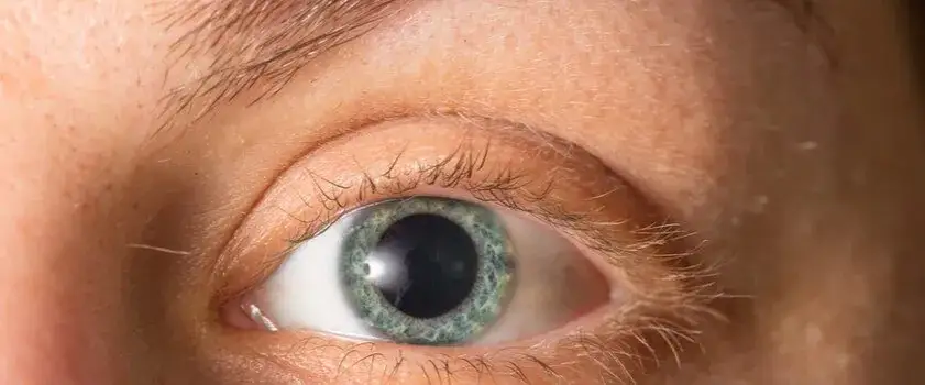 rozszerzone źrenice po psychodelikach vs normalne