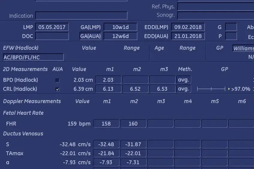 Kalkulator ciąży reguła Naegelego USG