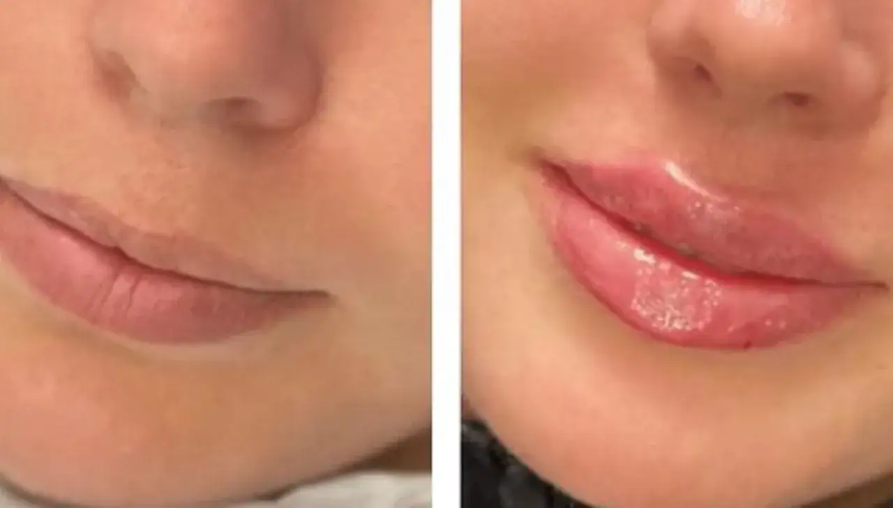 russian lips vs french lips