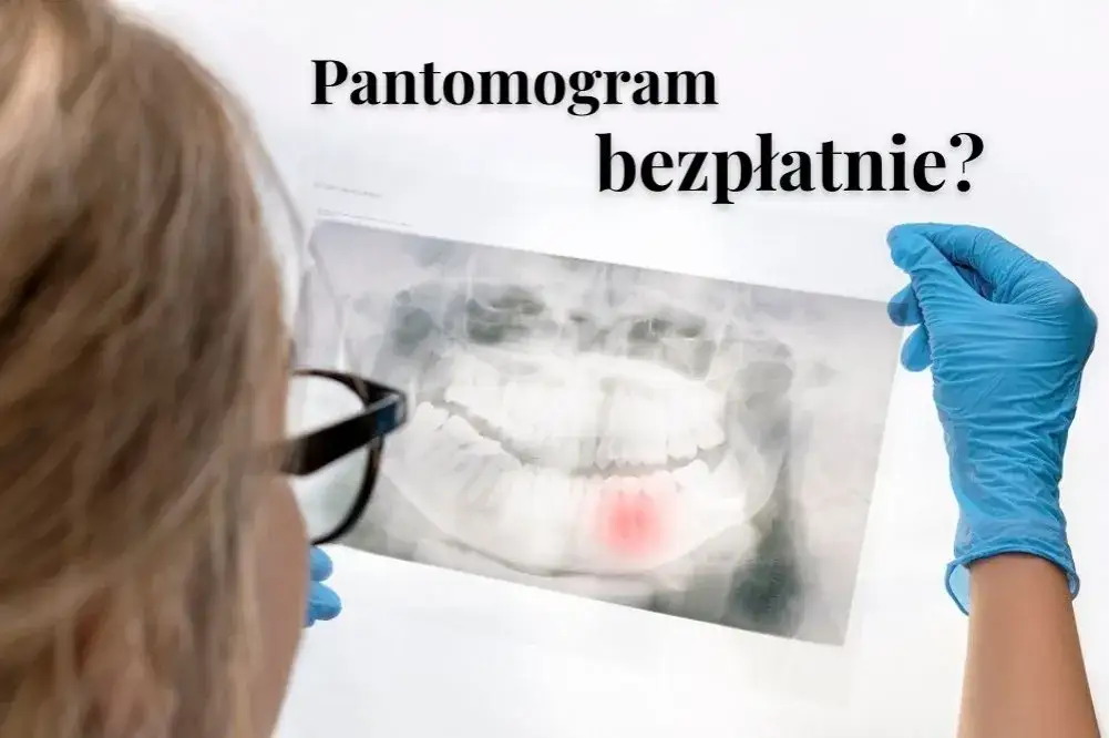 Zdjęcie Czy pantomogram jest na NFZ? Sprawdź, co musisz wiedzieć o refundacji