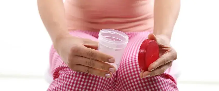 jak prawidłowo pobrać mocz do badania