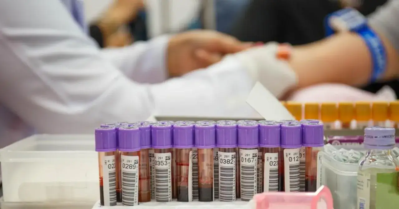 Pr&oacute;b&oacute;wki z krwią czekają na analizę. Badanie CRP to ważny wskaźnik stanu zapalnego.