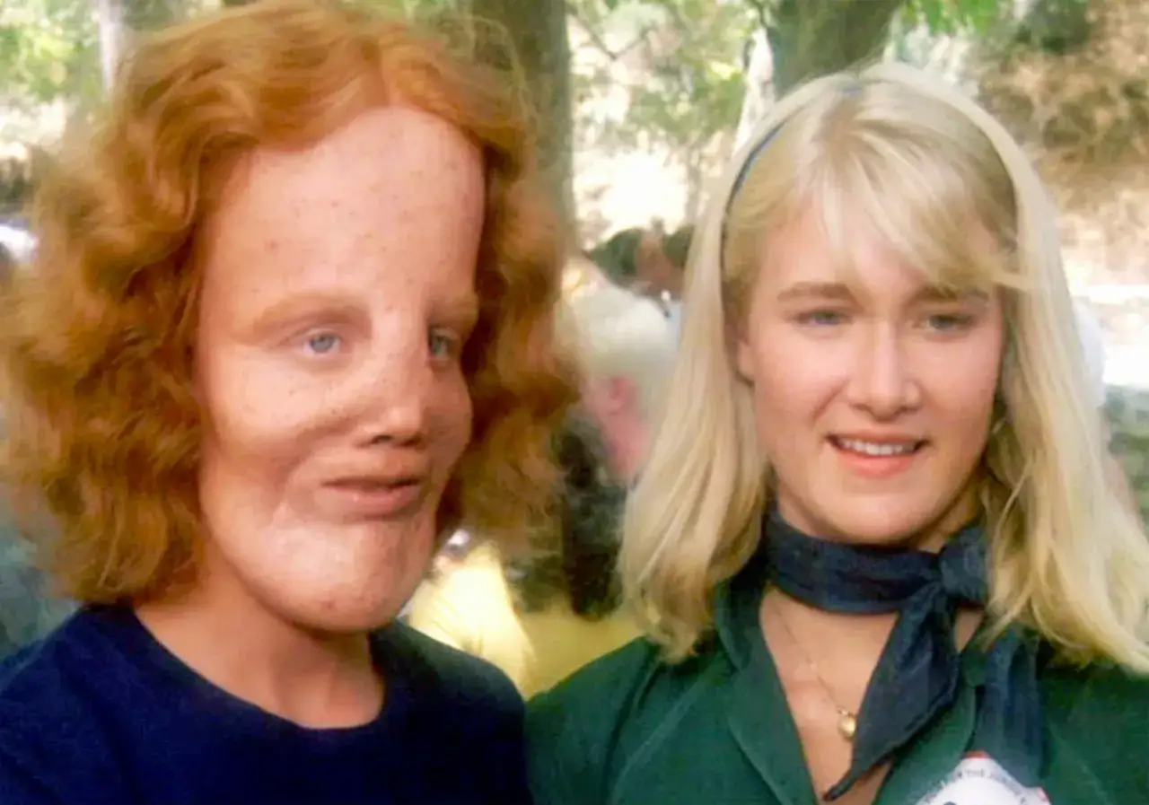 Charakteryzacja Maska film 1985 Eric Stoltz kulisy