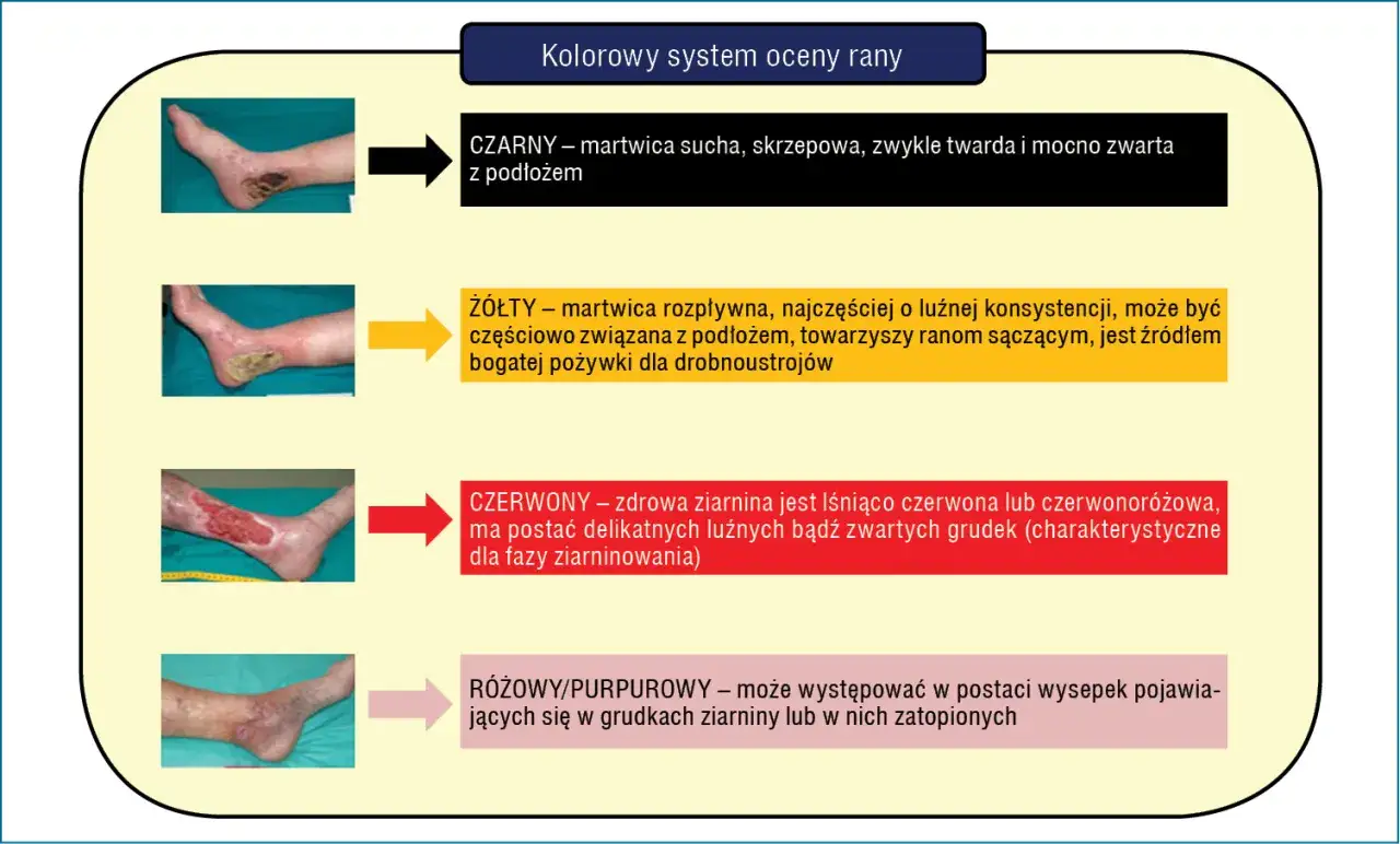 proces gojenia rany etapy