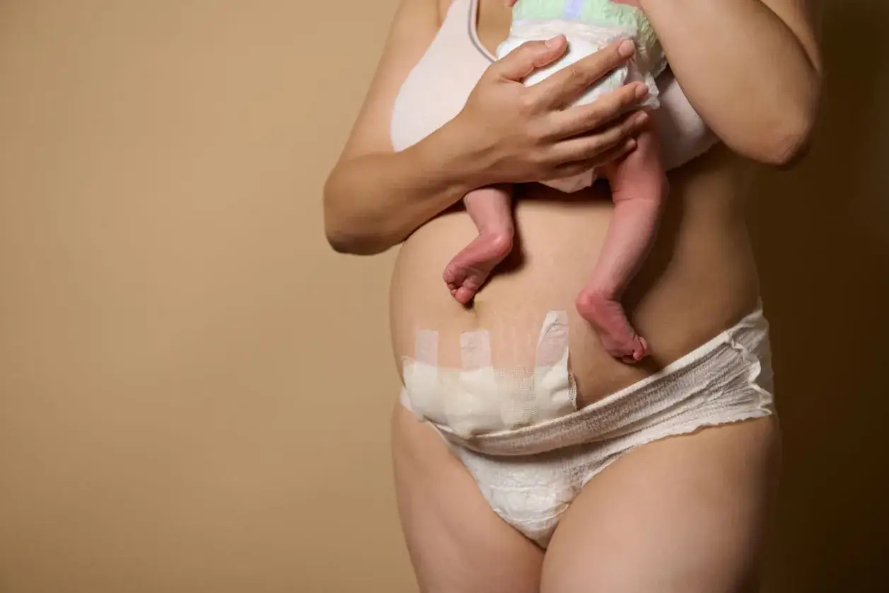 Kobieta z noworodkiem na rękach, z opatrunkiem na brzuchu po cesarskim cięciu. Zalecenia po CC obejmują troskę o ranę.